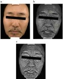 潜在的なシミをデジタル写真で計測する新手法～人工知能で肌の紫外線写真を生成して色素斑を計測～