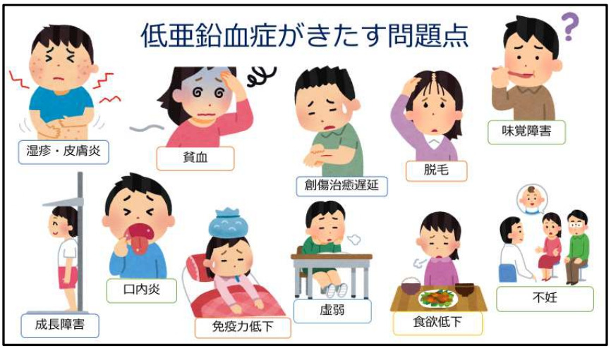 世界で初めて開発された「酢酸亜鉛顆粒剤」の薬事承認を取得