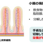 大腸に小腸特有の消化吸収機能を持たせる移植治療を開発