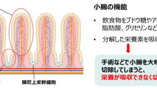 大腸に小腸特有の消化吸収機能を持たせる移植治療を開発