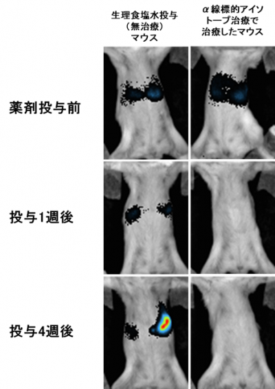 転移性胃がんに対するα線標的アイソトープ治療薬候補、肝転移にも有効