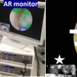 AR（強化現実）を用いた次世代型肘関節鏡手術の開発