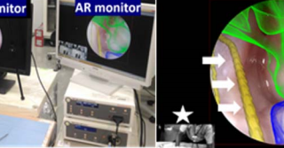 AR（強化現実）を用いた次世代型肘関節鏡手術の開発
