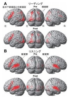 語学留学の脳科学的効用～外国語の習得によって言語野や感覚野の脳活動に変化～