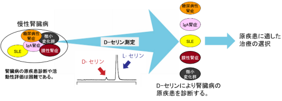 腎臓病の診断に有用なD-アミノ酸（D-セリン）を発見