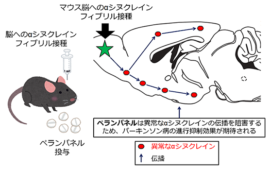パーキンソン病モデルへのペランパネルの有効性～パーキンソン病の進行抑制治療への期待～