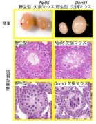精子形成におけるDNAメチル化の役割を解明～NP95とDNMT1の減数分裂期における新機能を発見～