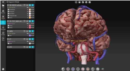 深層学習技術を応用した手術検討ソフトウェアでクラスⅡの医療機器の認証を取得