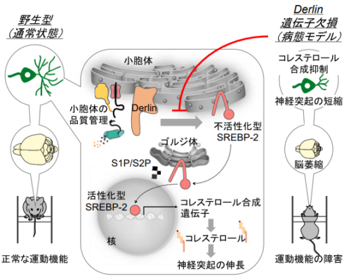 脳の萎縮のメカニズムを解明
