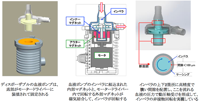 動圧浮上非接触回転型遠心ポンプを用いた体外設置型連続流補助人工心臓システム「バイオフロート補助人工心臓セットHC」の保険適用