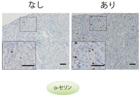 腎臓の細胞増殖を促進して機能を高めるD-アミノ酸(D-セリン)の新しい機能を発見
