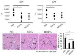肝臓由来の細胞外小胞の抗炎症機能を発見 ～急性肝障害の治療法に新たな道～