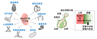 VATER症候群に類似する新規モデルマウスの作製に成功~VATER症候群の病態・発症メカニズムの解明に期待~