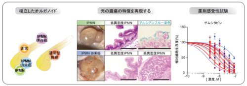 膵管内乳頭粘液性腫瘍(IPMN)に重要な腫瘍進展機構を新たに同定