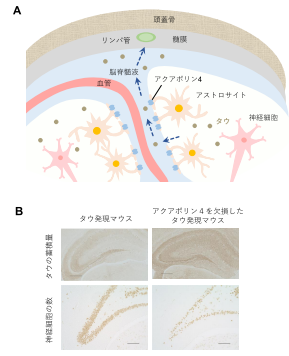 認知症の病因「タウタンパク質」が脳から除去されるメカニズムを解明