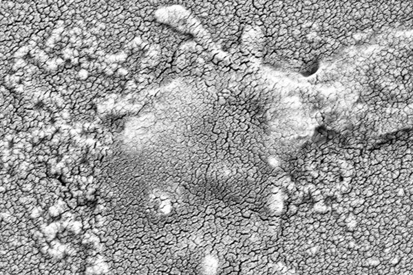 抗生物質耐性菌の薬剤を無効化する新手法を開発(New Method Can Disarm Antibiotic Resistance in Deadly Bacteria)