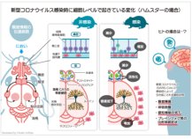 新型コロナウイルス(SARS-CoV-2)感染モデルにおける脳の変化