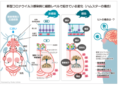 新型コロナウイルス(SARS-CoV-2)感染モデルにおける脳の変化