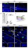 ジュベール症候群:知的障害と海馬の欠陥の関連性(Joubert Syndrome: the link between intellectual disability and defects in the hippocampus)