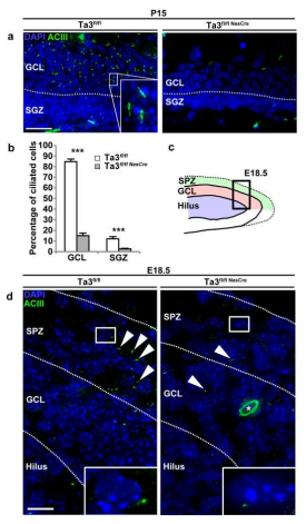 ジュベール症候群:知的障害と海馬の欠陥の関連性(Joubert Syndrome: the link between intellectual disability and defects in the hippocampus)