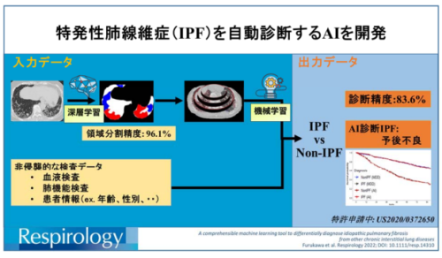 特発性肺線維症の自動診断AIの共同開発に成功
