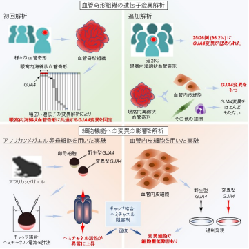 眼窩内海綿状血管奇形の新規疾患関連遺伝子変異(GJA4変異)を同定～血管奇形の新たな発症メカニズム解明や治療法開発につながる期待～