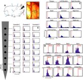 音+電気的身体刺激で慢性疼痛を治療できる可能性があるとの研究結果(Study finds that sound plus electrical body stimulation has potential to treat chronic pain)