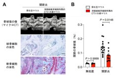 組織破壊型の線維芽細胞をつくる遺伝子 ETS1 の同定～関節リウマチ、がん、腸炎など、線維芽細胞が関わる疾患の治療に道～