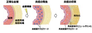 血管周囲の脂肪組織が過剰な血管炎症を抑えていることを発見～動脈硬化性疾患の新規治療標的として期待～