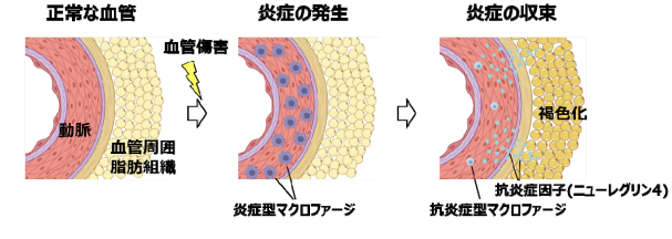 血管周囲の脂肪組織が過剰な血管炎症を抑えていることを発見~動脈硬化性疾患の新規治療標的として期待~ | テック・アイ生命科学