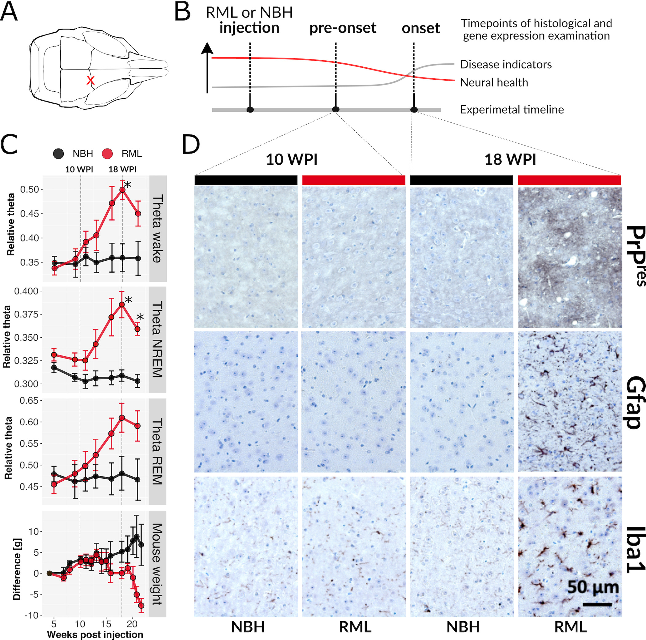 神経変性は、症状が出るずっと前から調べることができる(Neurodegeneration can be studied long before symptoms arise)