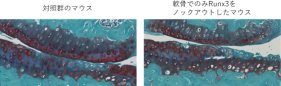 関節軟骨を守る2つの遺伝子～転写因子Runx2、Runx3による関節軟骨維持機構～