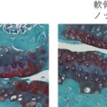 関節軟骨を守る2つの遺伝子～転写因子Runx2、Runx3による関節軟骨維持機構～