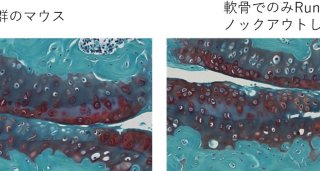 関節軟骨を守る2つの遺伝子～転写因子Runx2、Runx3による関節軟骨維持機構～