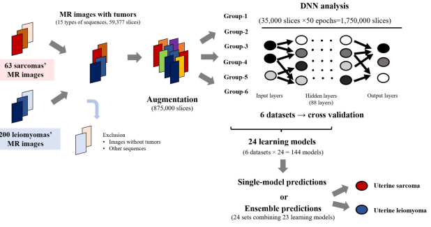 AIを用いた子宮肉腫の術前画像診断システムを開発