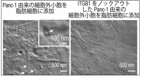 がんになるとなぜ痩せるのか ～膵がん由来の細胞外小胞が脂肪分解を引き起こすメカニズムを解明～