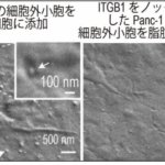 がんになるとなぜ痩せるのか ～膵がん由来の細胞外小胞が脂肪分解を引き起こすメカニズムを解明～