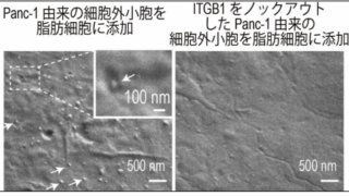 がんになるとなぜ痩せるのか ～膵がん由来の細胞外小胞が脂肪分解を引き起こすメカニズムを解明～
