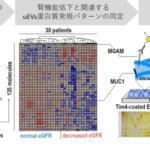 腎臓病の診断に応用できる新たな尿検査法を開発 腎臓病の診断に応用できる新たな尿検査法を開発
