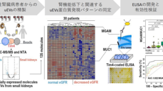 腎臓病の診断に応用できる新たな尿検査法を開発