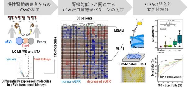 腎臓病の診断に応用できる新たな尿検査法を開発