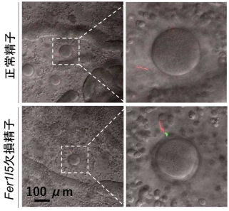 精子の受精能獲得を制御する分子を発見 ～帽子を脱げず卵子と受精できない精子～
