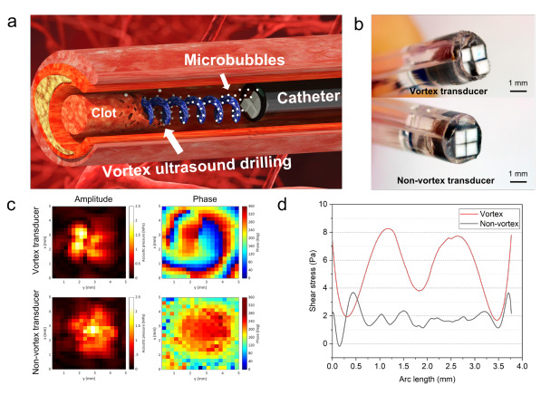 超音波の「トルネード」で血栓を分解する新ツールを開発(New Tool Uses Ultrasound &lsquo;Tornado&rsquo; to Break Down Blood Clots)