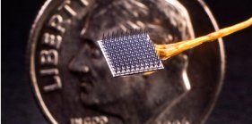 思考を行動に移すブレイン・コンピューター・インターフェースの臨床試験で、優れた安全性プロファイルを確認(Clinical trials show encouraging safety profile for brain-computer interface turning thoughts into action)