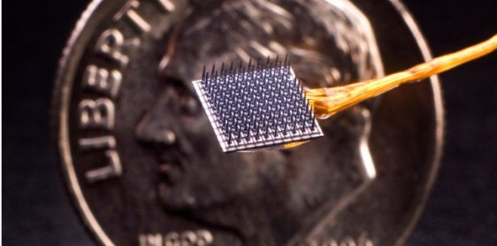 思考を行動に移すブレイン・コンピューター・インターフェースの臨床試験で、優れた安全性プロファイルを確認(Clinical trials show encouraging safety profile for brain-computer interface turning thoughts into action)
