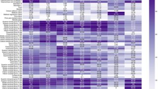 AIが希少な認知症を検出(AI detects rare forms of dementia)