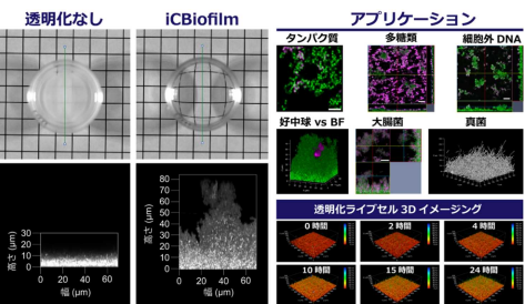 バイオフィルムを数秒で透明化する新技術「iCBiofilm」を開発 ～内部の微細構造や生きたままの微生物を深部まで観察することが可能に～