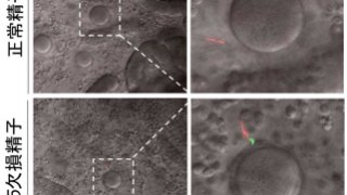 精子の受精能獲得を制御する分子を発見 ～帽子を脱げず卵子と受精できない精子～