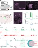 パーキンソン病において、運動は感覚を低下させる(Movement reduces sensory responses in Parkinson’s disease)