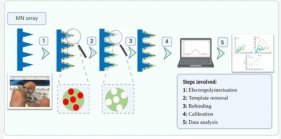 新開発の「スマートパッチ」がアルツハイマー病の検出に利用できる可能性(Newly developed ‘smart patch’ could be used to detect Alzheimer’s)